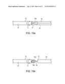 TELESCOPING URETERAL STENT diagram and image