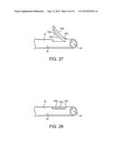 TELESCOPING URETERAL STENT diagram and image