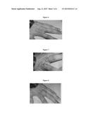 Therapeutic Methods And Pharmaceutical Compositions For Treating Warts     With Tellurium Compounds diagram and image