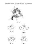 RESORBABLE OXIDIZED CELLULOSE EMBOLIZATION SOLUTION diagram and image