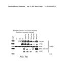 PREPARATION OF ANTIBODY OR AN ANTIBODY FRAGMENT TARGETED IMMUNOLIPOSOMES     FOR SYSTEMIC ADMINISTRATION OF THERAPEUTIC OR DIAGNOSTIC AGENTS AND USES     THEREOF diagram and image