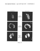 PREPARATION OF ANTIBODY OR AN ANTIBODY FRAGMENT TARGETED IMMUNOLIPOSOMES     FOR SYSTEMIC ADMINISTRATION OF THERAPEUTIC OR DIAGNOSTIC AGENTS AND USES     THEREOF diagram and image