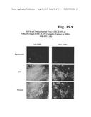 PREPARATION OF ANTIBODY OR AN ANTIBODY FRAGMENT TARGETED IMMUNOLIPOSOMES     FOR SYSTEMIC ADMINISTRATION OF THERAPEUTIC OR DIAGNOSTIC AGENTS AND USES     THEREOF diagram and image