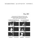 PREPARATION OF ANTIBODY OR AN ANTIBODY FRAGMENT TARGETED IMMUNOLIPOSOMES     FOR SYSTEMIC ADMINISTRATION OF THERAPEUTIC OR DIAGNOSTIC AGENTS AND USES     THEREOF diagram and image