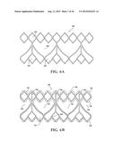 COHERENT SINGLE LAYER HIGH STRENGTH SYNTHETIC POLYMER COMPOSITES FOR     PROSTHETIC VALVES diagram and image