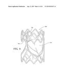 COHERENT SINGLE LAYER HIGH STRENGTH SYNTHETIC POLYMER COMPOSITES FOR     PROSTHETIC VALVES diagram and image