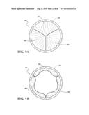 COHERENT SINGLE LAYER HIGH STRENGTH SYNTHETIC POLYMER COMPOSITES FOR     PROSTHETIC VALVES diagram and image