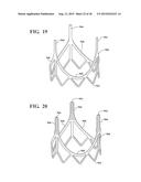COHERENT SINGLE LAYER HIGH STRENGTH SYNTHETIC POLYMER COMPOSITES FOR     PROSTHETIC VALVES diagram and image