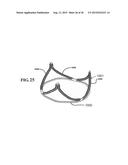 COHERENT SINGLE LAYER HIGH STRENGTH SYNTHETIC POLYMER COMPOSITES FOR     PROSTHETIC VALVES diagram and image