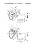 TISSUE ENUCLEATION DEVICES AND RELATED METHODS diagram and image