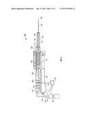 Delivery system for injections throughout zone of body diagram and image