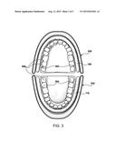 FACIAL EXERCISER diagram and image