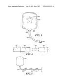 Method and Apparatus for a Squeezable Food Container Having a Direct     Feeding Tube Connector diagram and image