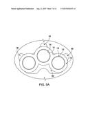 Reciprocating Refrigeration Compressor Suction Valve Seating diagram and image