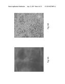 ANOMALY DETECTION IN MEDICAL IMAGERY diagram and image