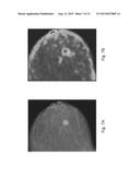 ANOMALY DETECTION IN MEDICAL IMAGERY diagram and image