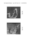 ANOMALY DETECTION IN MEDICAL IMAGERY diagram and image