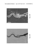 ANOMALY DETECTION IN MEDICAL IMAGERY diagram and image