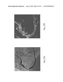 ANOMALY DETECTION IN MEDICAL IMAGERY diagram and image