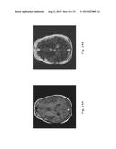 ANOMALY DETECTION IN MEDICAL IMAGERY diagram and image