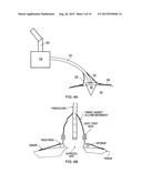 FIBRESCOPE FOR OPTICAL IMAGING OF RADIOPHARMACEUTICALS diagram and image