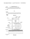 PIXEL ARRAY MEDICAL DEVICES AND METHODS diagram and image