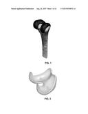 PERSONALIZED ORTHOPEDIC IMPLANT CAD MODEL GENERATION diagram and image