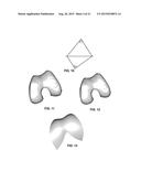 PERSONALIZED ORTHOPEDIC IMPLANT CAD MODEL GENERATION diagram and image