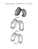 PERSONALIZED ORTHOPEDIC IMPLANT CAD MODEL GENERATION diagram and image