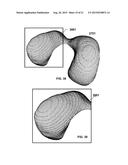 PERSONALIZED ORTHOPEDIC IMPLANT CAD MODEL GENERATION diagram and image