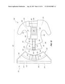 Orthodontic Bracket diagram and image