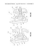 Orthodontic Bracket diagram and image