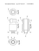 Dental Implant System diagram and image