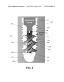 HYBRID DENTAL IMPLANT diagram and image