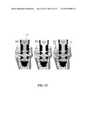 HYBRID DENTAL IMPLANT diagram and image