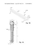 MEDICAL IMPLANT AND METHOD OF IMPLANTATION diagram and image