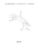 DENTURE REFERENCE AND REGISTRATION SYSTEM diagram and image