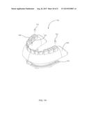 DENTURE REFERENCE AND REGISTRATION SYSTEM diagram and image