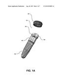 Dental Device for Anchoring a Denture to an Implant diagram and image