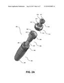 Dental Device for Anchoring a Denture to an Implant diagram and image