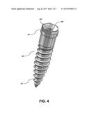 Dental Device for Anchoring a Denture to an Implant diagram and image