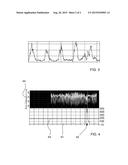 DEVICE FOR DETECTING AND INDICATING THE PREPARATORY PHASE OF BIRTHING A     BOVINE OR EQUINE ANIMAL, AND CORRESPONDING METHOD AND COMPUTER PROGRAM     PRODUCT diagram and image