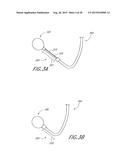 METHOD AND APPARATUS FOR DELIVERING AN IMPLANT WITHOUT BIAS TO A LEFT     ATRIAL APPENDAGE diagram and image