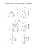 METHOD AND APPARATUS FOR DELIVERING AN IMPLANT WITHOUT BIAS TO A LEFT     ATRIAL APPENDAGE diagram and image