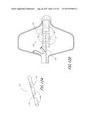 METHOD AND APPARATUS FOR DELIVERING AN IMPLANT WITHOUT BIAS TO A LEFT     ATRIAL APPENDAGE diagram and image