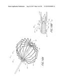 METHOD AND APPARATUS FOR DELIVERING AN IMPLANT WITHOUT BIAS TO A LEFT     ATRIAL APPENDAGE diagram and image