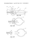 METHOD AND APPARATUS FOR DELIVERING AN IMPLANT WITHOUT BIAS TO A LEFT     ATRIAL APPENDAGE diagram and image