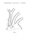 DUAL ENDOVASCULAR FILTER AND METHODS OF USE diagram and image