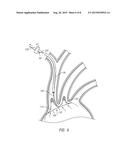 DUAL ENDOVASCULAR FILTER AND METHODS OF USE diagram and image