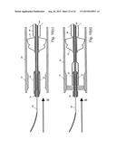 EMBOLIC PROTECTION SYSTEM diagram and image